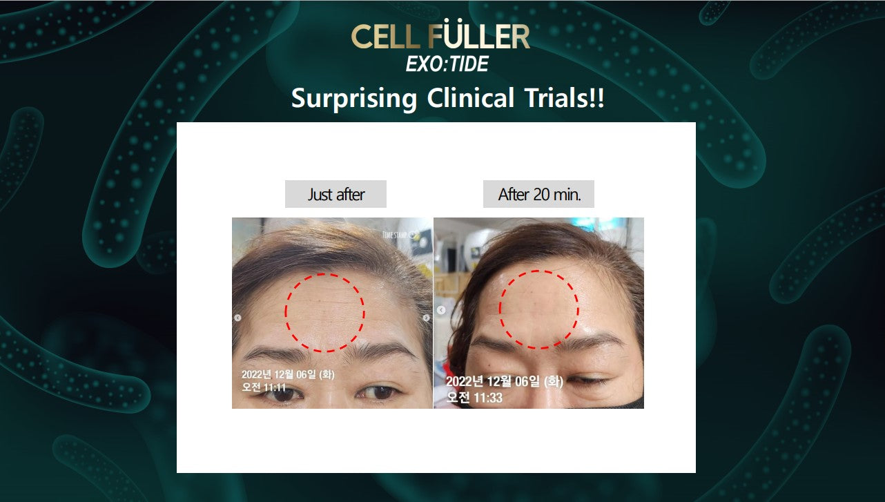 Tinh chất dạng sủi trẻ hóa PSI Cell Fuller Exotide Essence