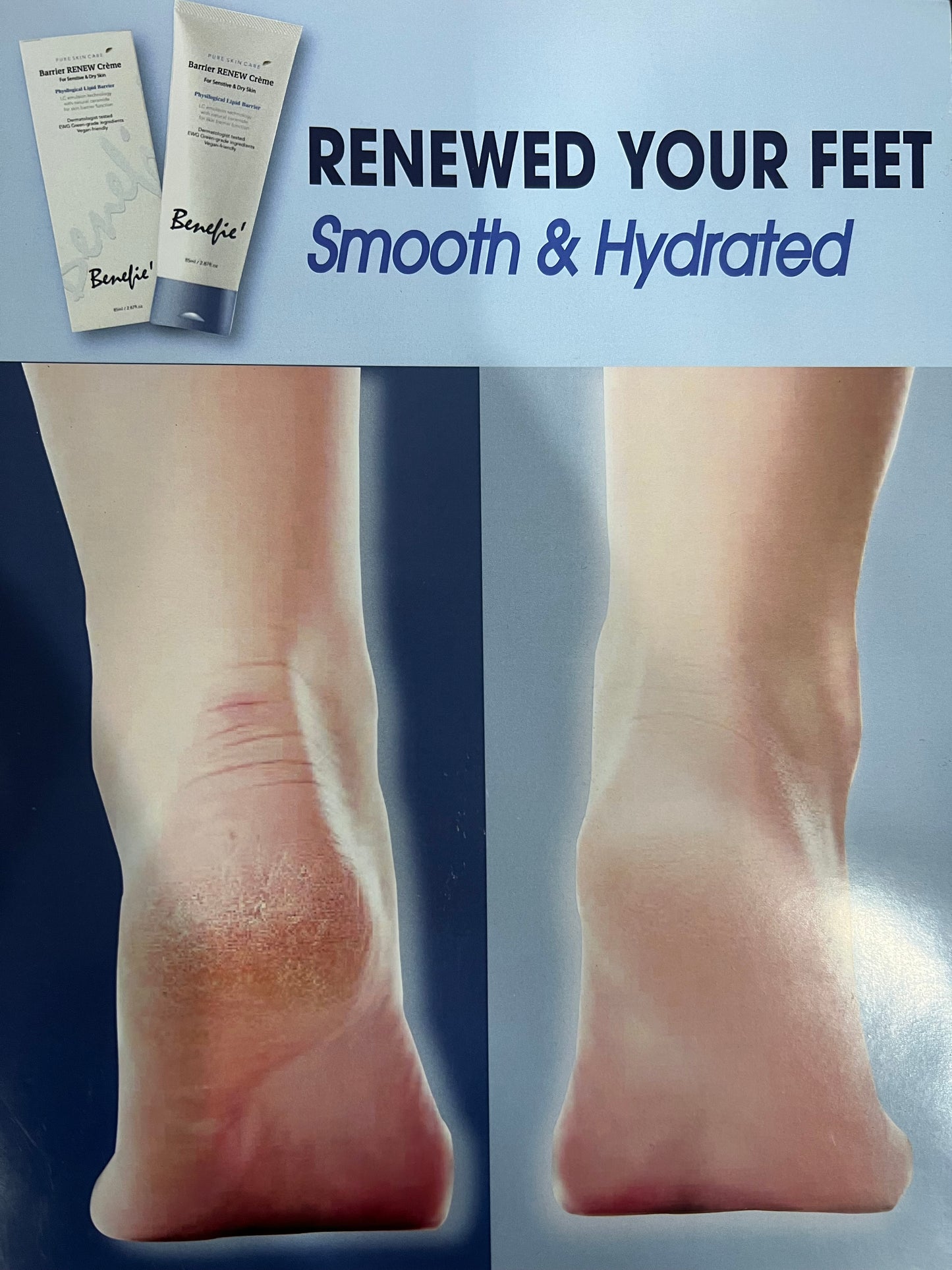 Kem dưỡng ẩm làm dịu Benefie' BARRIER Renew Foot Cream 85ml